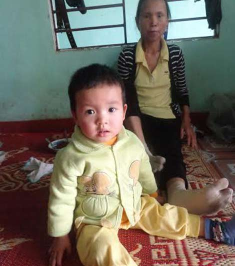 Nỗi đau người mẹ sinh 7 đứa con thì 6 đứa bị tim bẩm sinh