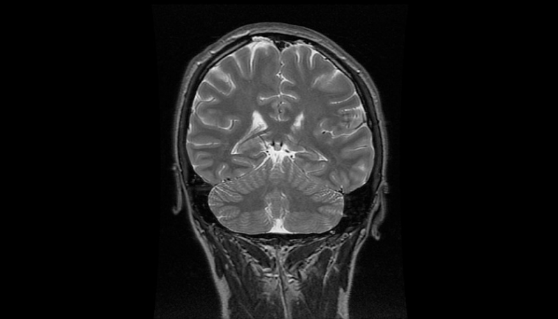 Tụng Kinh Giảm Bớt Stress